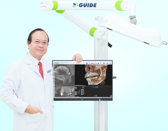 Công nghệ định vị X-Guide