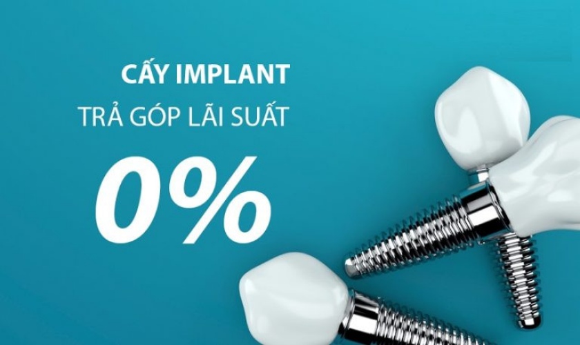 Trồng răng 0% lãi suất