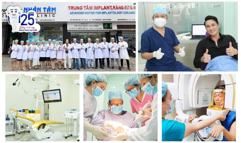 Implant Center - nha khoa chuyên sâu về cấy ghép Implant