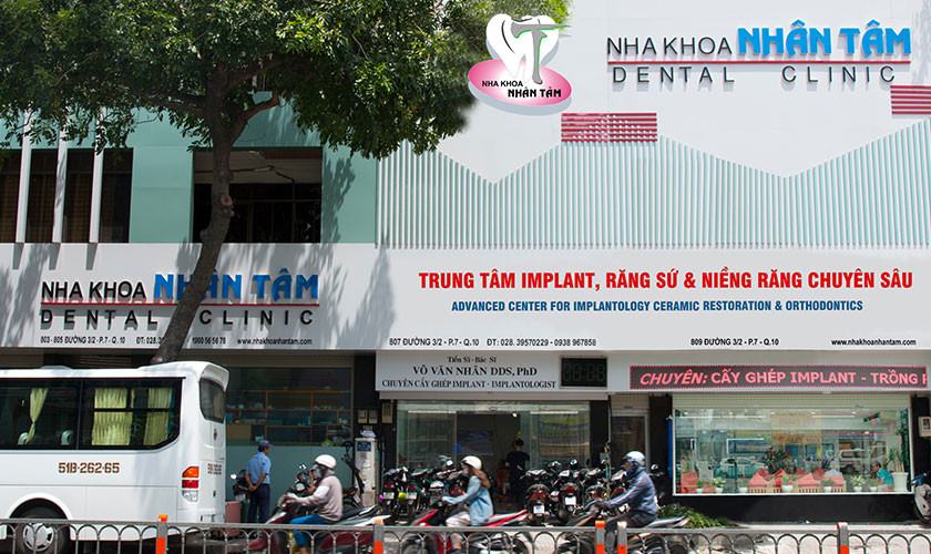 Implant Center - Nha khoa với hơn 25 năm hoạt động