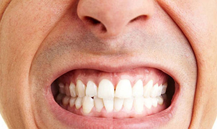 Nghiến răng là tình trạng thường gặp ở mọi lứa tuổi