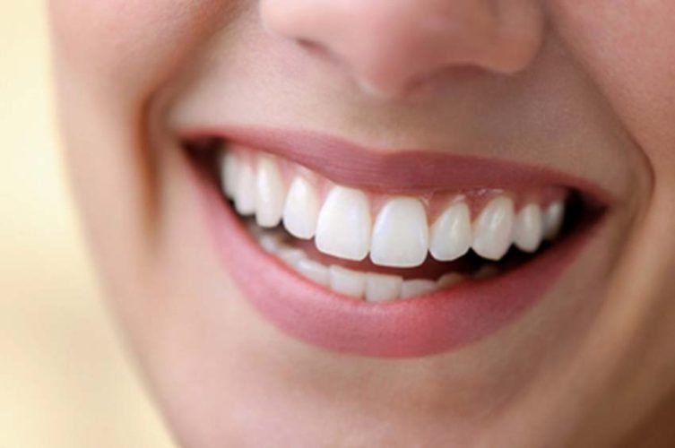 Răng tạm giúp cải thiện thẩm mỹ và chức năng ăn nhai trong thời gian đợi Implant và xương tích hợp