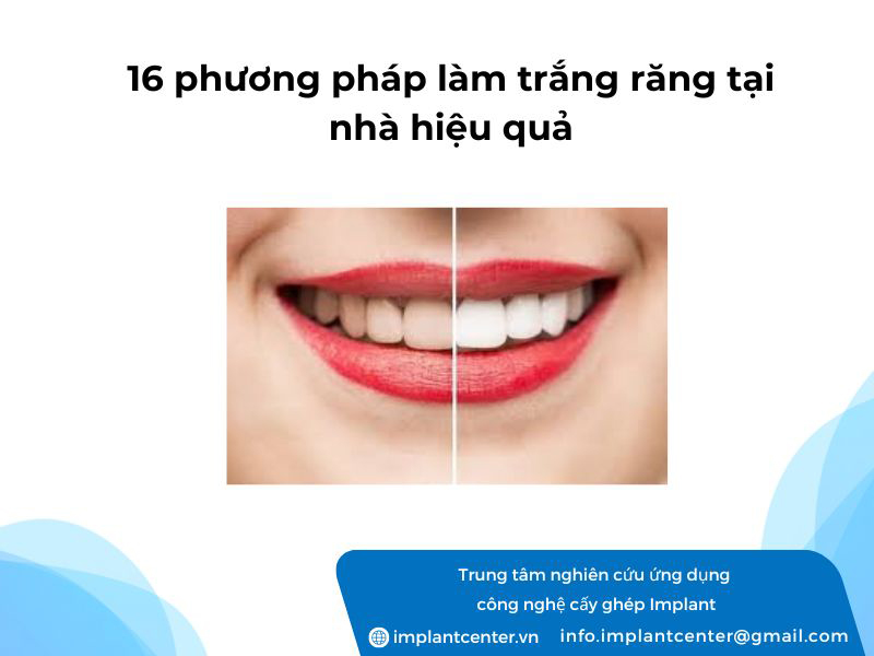 16 phương pháp làm trắng răng tại nhà