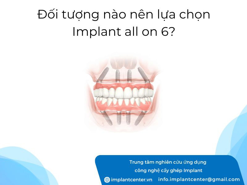 Đối tượng nào nên lựa chọn Implant All On 6