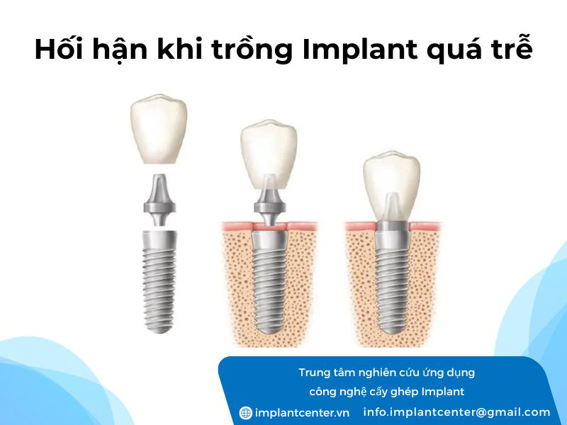 Hối hận khi trồng implant quá trễ