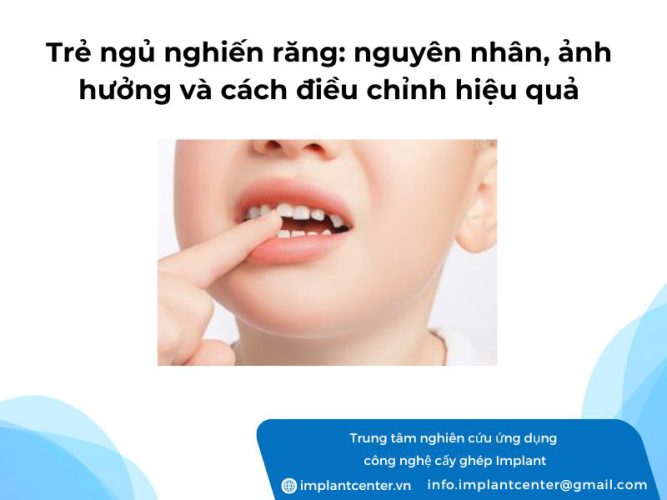 Trẻ ngủ nghiến răng: nguyên nhân, ảnh hưởng và cách điều chỉnh hiệu quả