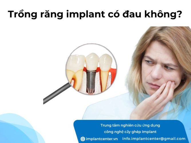 Trồng răng Implant có đau không