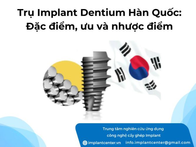 Trụ Implant Dentium Hàn Quốc có đặc điểm gì? Ưu và nhược điểm của loại trụ này khi thực hiện cấy ghép