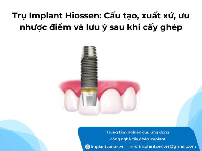 Trụ Implant Hiossen: cấu tạo, xuất xứ, ưu nhược điểm và lưu ý sau khi cấy ghép