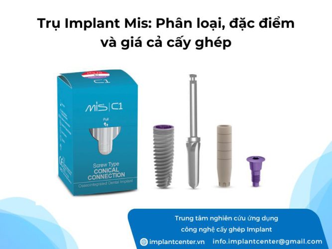 Trụ Implant Mis phân loại, đặc điểm và giá cả trồng Implant Mis