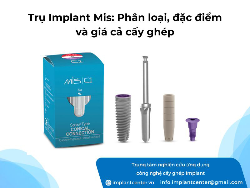 Trụ Implant Mis: phân loại, nguồn gốc, cấu tạo và giá cấy răng Implant Mis