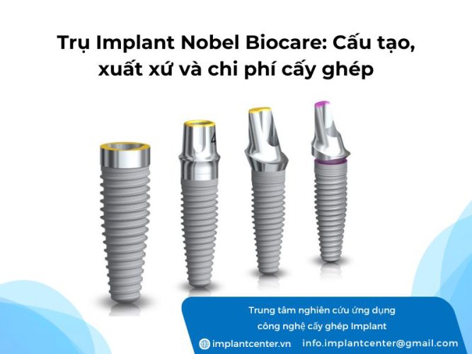Trụ Implant Nobel Biocare: cấu tạo xuất xứ và chi phí cấy ghép Implant Noble hiện nay