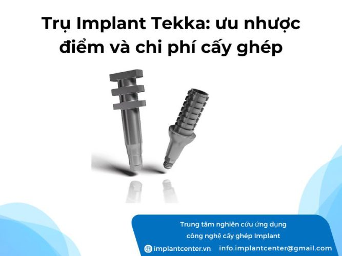 Trụ Implant Tekka: ưu, nhược điểm và chi phí cấy ghép