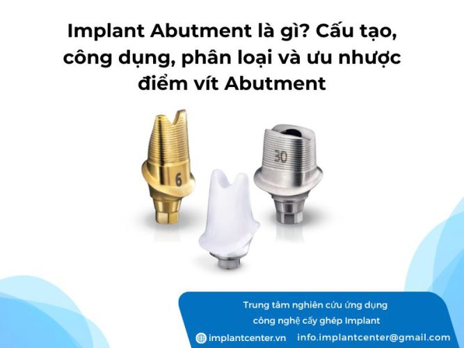 Implant Abutemnt là gì? Cấu tạo công dụng phân loại và ưu nhược điểm vít Abutment