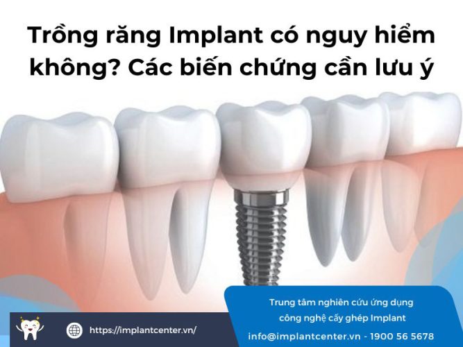 Trồng răng Implant có nguy hiểm không