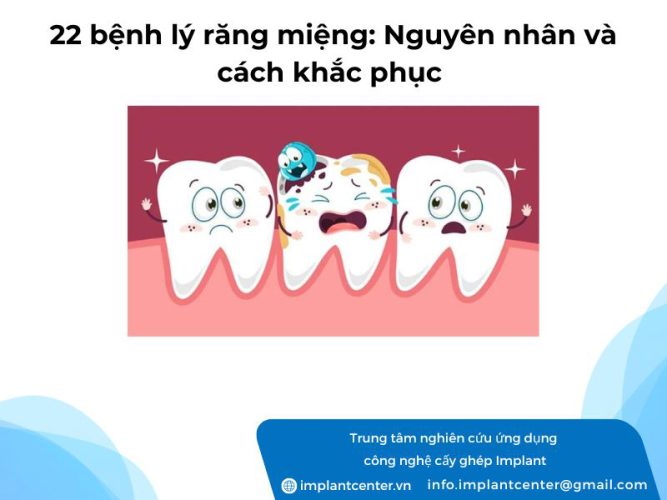 22 bệnh lý răng miệng: nguyên nhân và cách khắc phục
