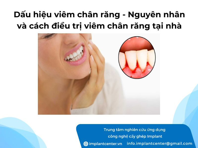 Dấu hiệu viêm chân răng là gì? Nguyên nhân và phương pháp điều trị viêm chân răng tại nhà