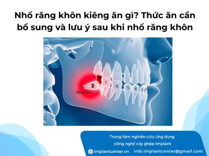 Nhổ răng khôn kiêng ăn gì? Thức ăn cần bổ sung và lưu ý sau khi nhổ răng khôn