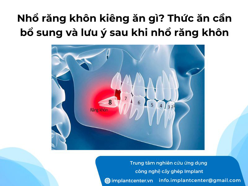 Nhổ răng khôn kiêng ăn gì? Thức ăn cần bổ sung và lưu ý sau khi nhổ răng khôn