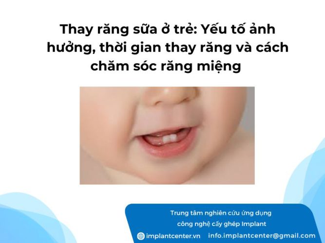 Thay răng sữa ở trẻ yếu tố ảnh hưởng thời gian thay răng và cách chăm sóc răng miệng