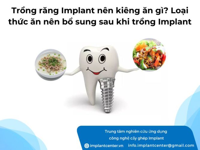 Trồng răng Implant nên kiêng ăn gì? Các loại thức ăn bổ sung sau khi trồng răng Implant