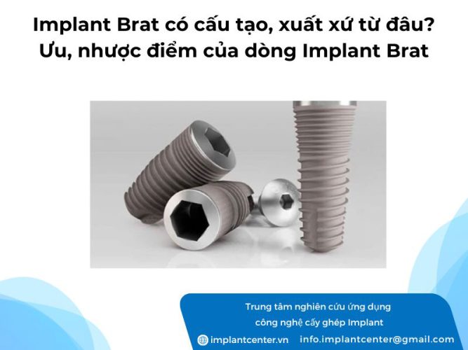 Trụ Implant Brat có cấu tạo xuất xứ từ đâu? Ưu và nhược điểm của dòng Implant Brat