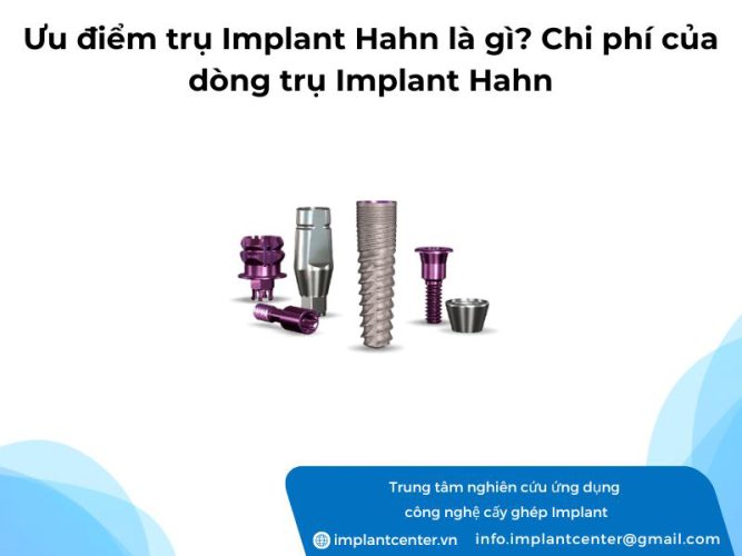 Ưu điểm trụ Implant Hahn là gì? Chi phí của dòng trụ Implant Hahn