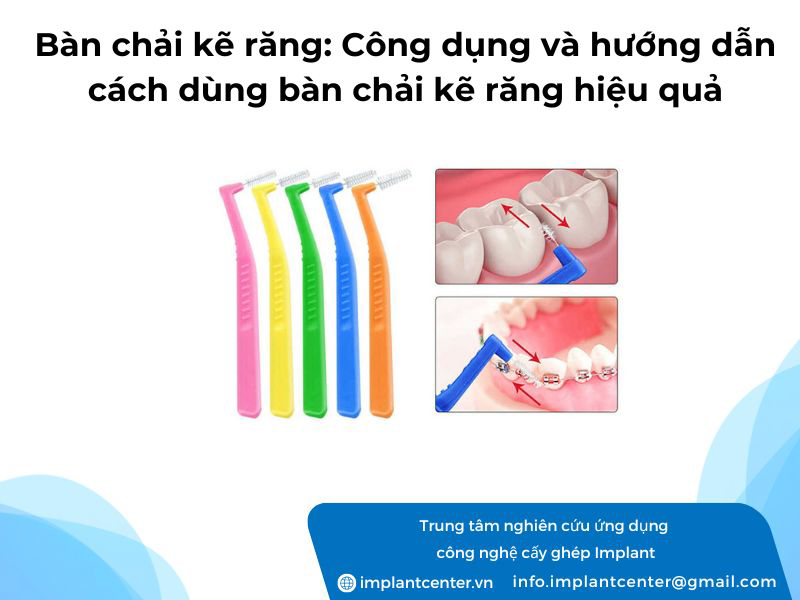 Bàn chải kẽ răng: Công dụng và hướng dẫn cách dùng bàn chải kẽ răng hiệu quả