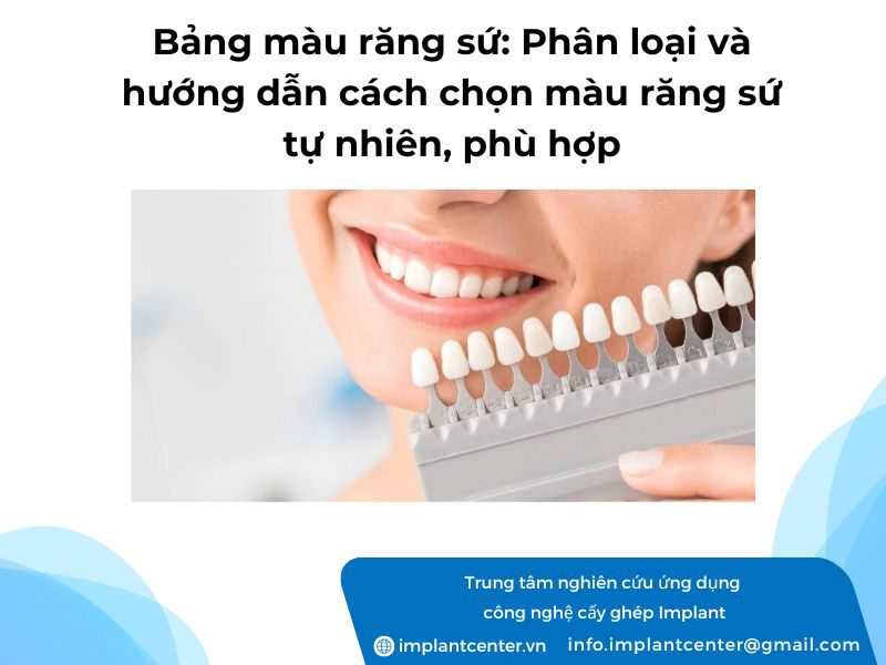 Bảng màu răng sứ: Phân loại và hướng dẫn cách chọn màu răng sứ tự nhiên, phù hợp