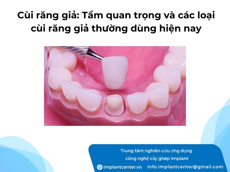 Cùi răng giả: tầm quan trọng và các loại cùi răng giả thường dùng hiện nay