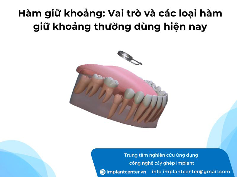 Hàm giữ khoảng: Vai trò và các loại hàm giữ khoảng thường dùng hiện nay
