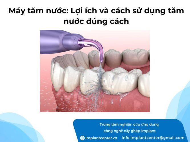 Máy tăm nước: Lợi ích và cách sử dụng tăm nước đúng cách