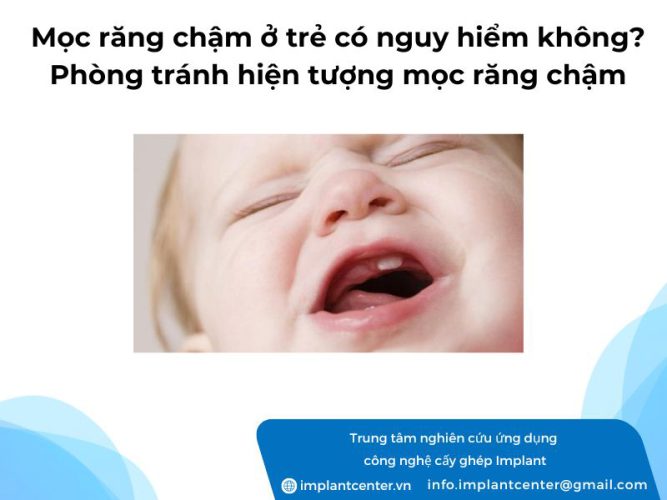 Mọc răng chậm ở trẻ có nguy hiểm không? Cách phòng tránh hiện tượng mọc răng chậm
