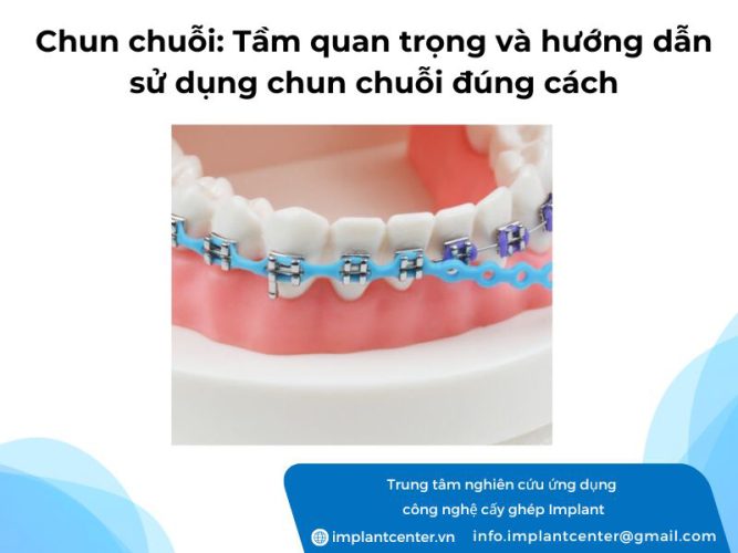 Chun chuỗi: Tầm quan trọng và hướng dẫn sử dụng chun chuỗi đúng cách