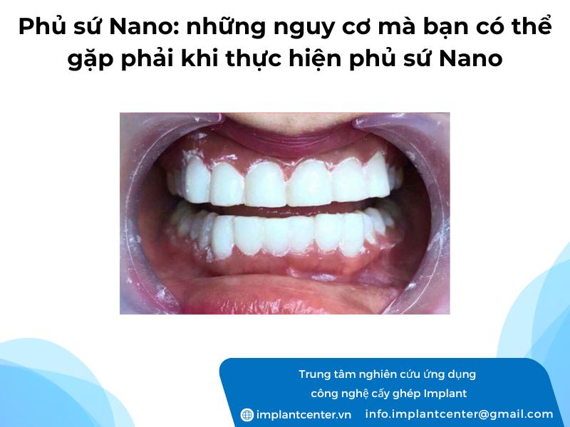 Phủ sứ Nano những nguy cơ mà bạn có thể tặp phải khi thực hiện phủ sứ Nano