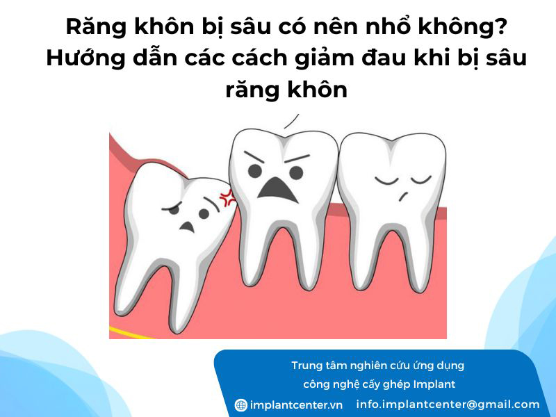 Răng khôn bị sâu có nên nhổ không? Hướng dẫn các cách giảm đau khi bị sâu răng khôn