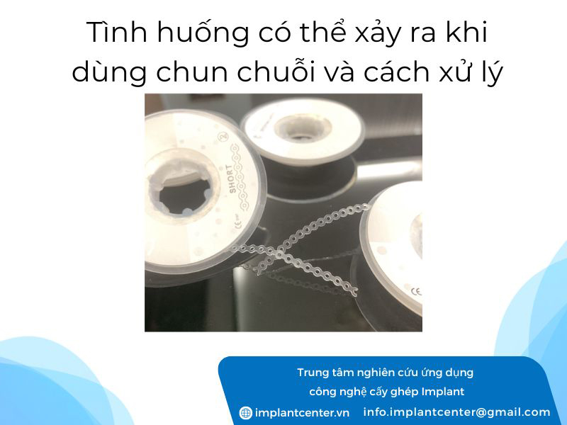 Tình huống có thể xảy ra khi dùng chun chuỗi và cách xử lý