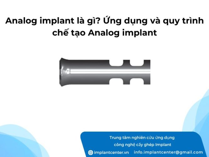 Analog-implant-la-gi-Ung-dung-va-quy-trinh-che-tao-Analog-implant