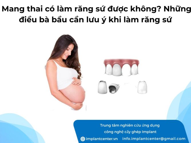 mang-thai-lam-rang-su-duoc-khong