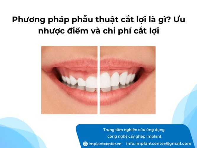 Phuong-phap-phau-thuat-cat-loi-la-gi-uu-nhuoc-diem-va-chi-phi