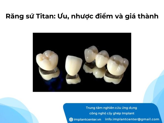 Rang-su-Titan-Uu-nhuoc-diem-va-gia-thanh