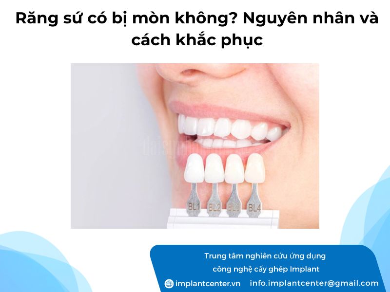 Rang-su-co-bi-mon-khong-Nguyen-nhan-va-cach-khac-phuc