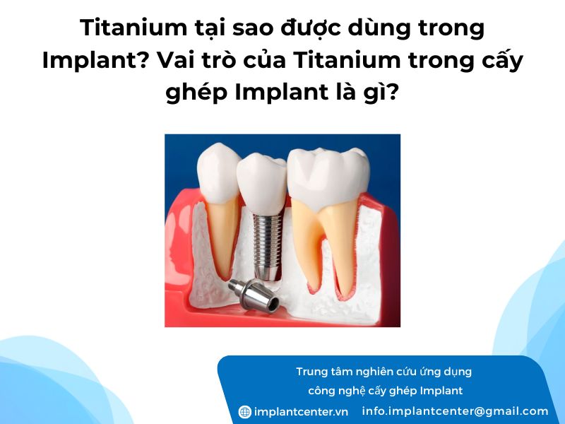 Titanium-tai-sao-duoc-dung-trong-Implant-Vai-tro-cua-Titanium-trong-cay-ghep-Implant-la-gi