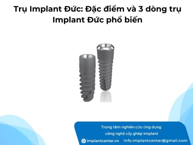 Tru-Implant-Duc-Dac-diem-va-3-dong-tru-Implant-Duc-pho-bien