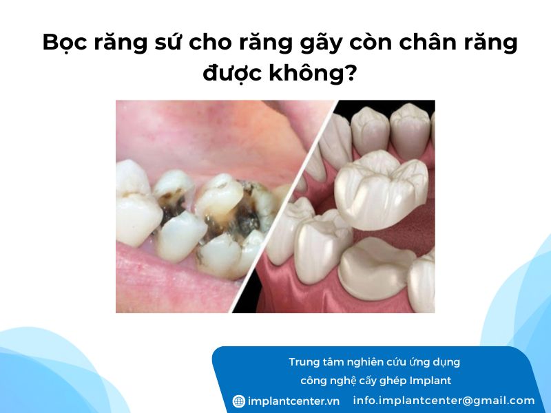 Boc-rang-su-cho-rang-gay-con-chan-rang-duoc-khong