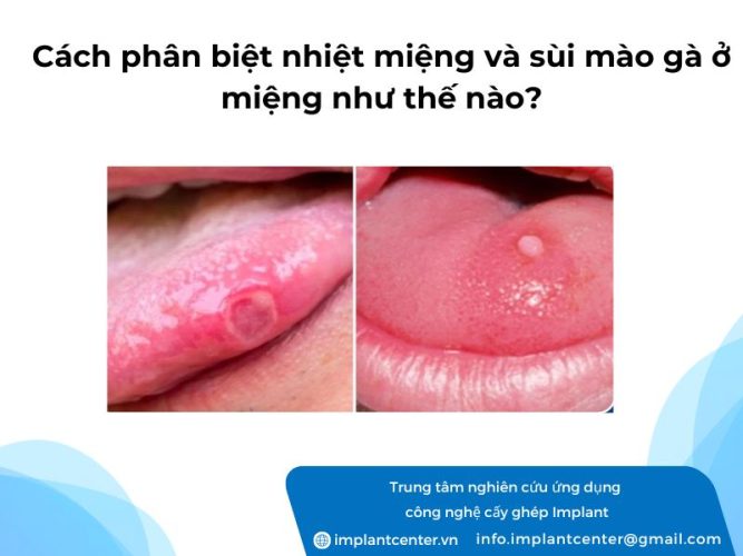 Cach-phan-biet-nhiet-mieng-va-sui-mao-ga-o-mieng