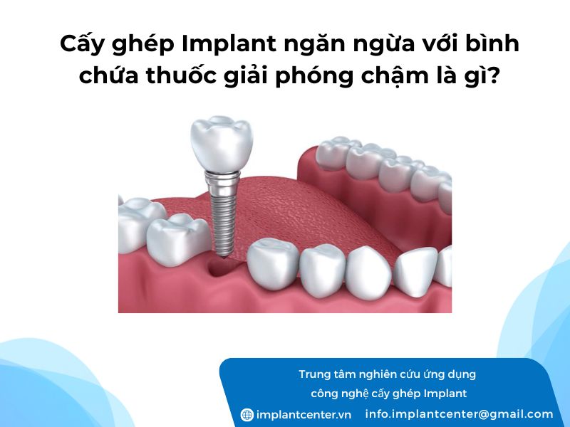 Cay-ghep-ngan-ngua-voi-binh-chua-thuoc-giai-phong-cham-la-gi