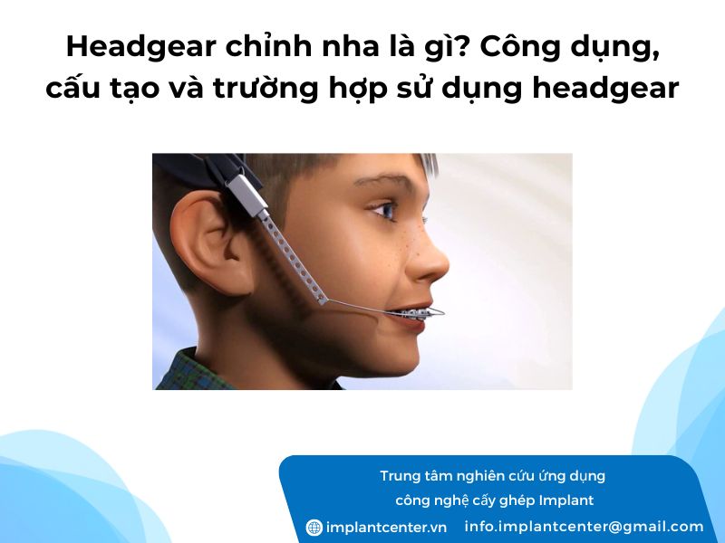 Headgear-chinh-nha-la-gi-Cong-dung-cau-tao-va-truong-hop-su-dung-headgear