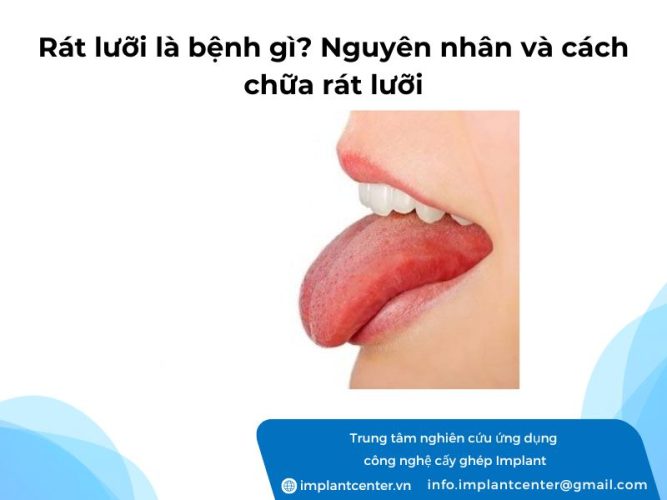 Rat-luoi-la-benh-gi-Nguyen-nhan-va-cach-chua-rat-luoi