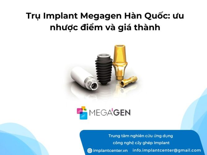 Tru-Implant-Megagen-Han-Quoc-uu-nhuoc-diem-va-gia-thanh